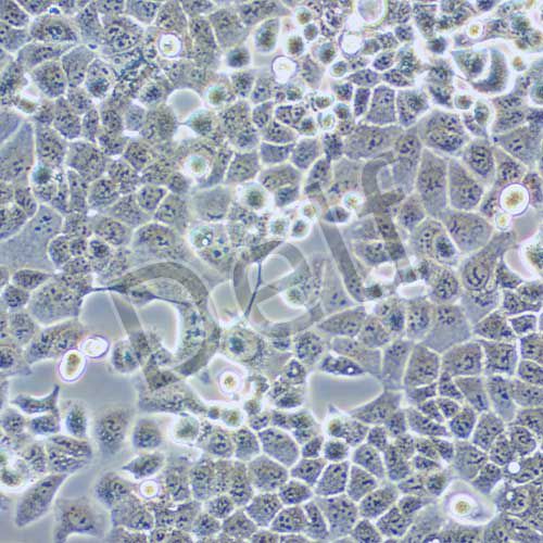HEC-1-B 人子宮內(nèi)膜腺癌細(xì)胞