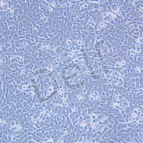 HEPA1-6 小鼠肝癌細(xì)胞
