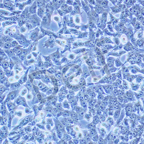 HEPA1-6 小鼠肝癌細(xì)胞
