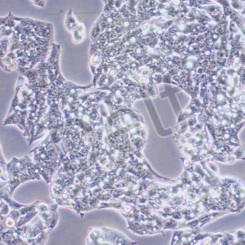 Hep G2 人肝癌細(xì)胞