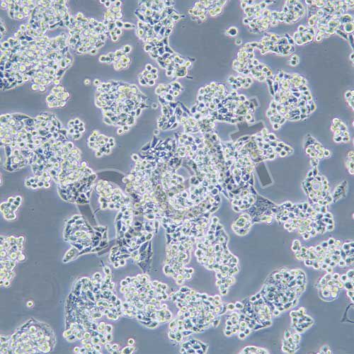 Hep G2.2.15 人肝癌(HBV)