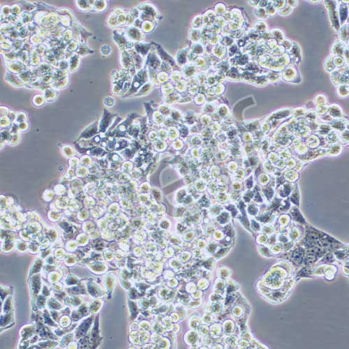 Hep G2.2.15 人肝癌(HBV)