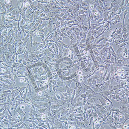 HEY 人卵巢癌細胞