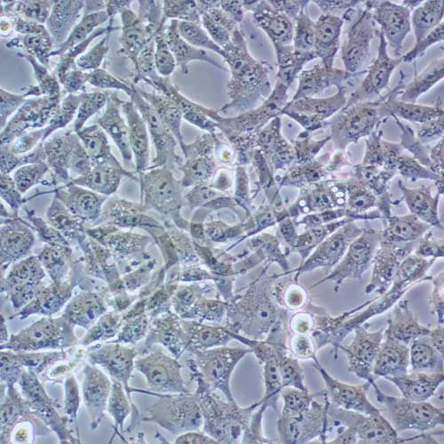 HEY 人卵巢癌細胞