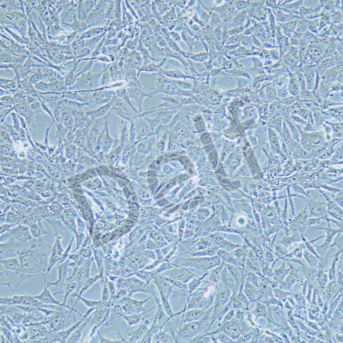 HEY A8 人卵巢癌細胞