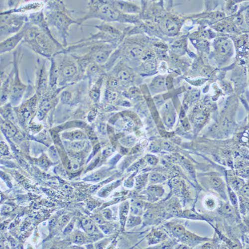 HEY A8 人卵巢癌細胞