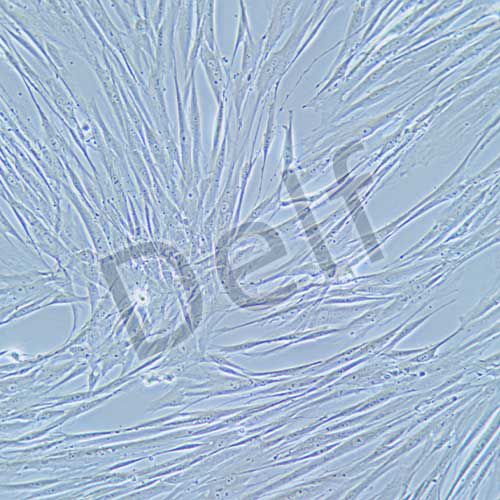 HFL1 人胚肺成纖維細(xì)胞