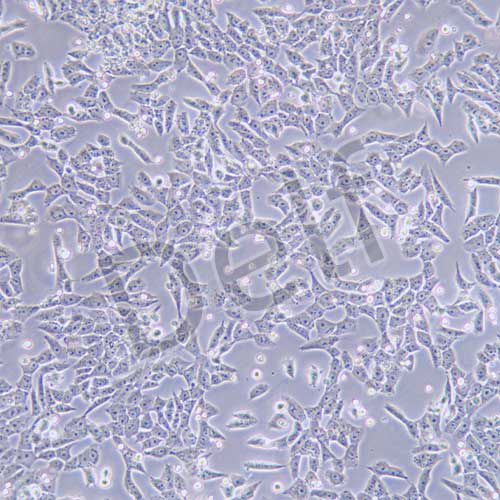 HGC-27 人胃癌細胞