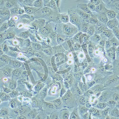 HT-1080 人纖維肉瘤細胞