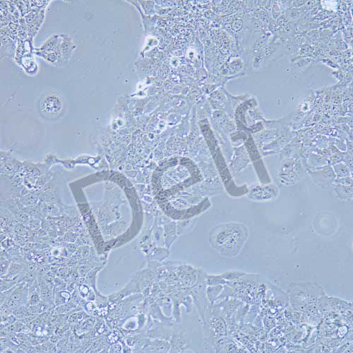 HT-1376 人膀胱癌細(xì)胞
