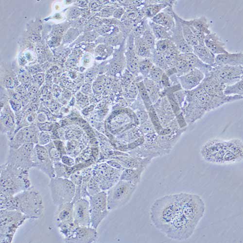 HT-1376 人膀胱癌細(xì)胞