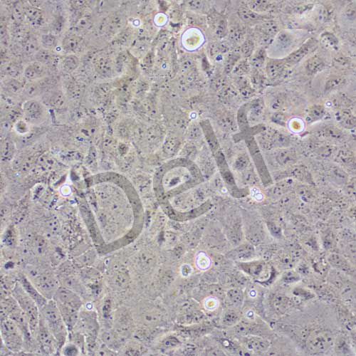 HuCCT1 人膽管癌細(xì)胞