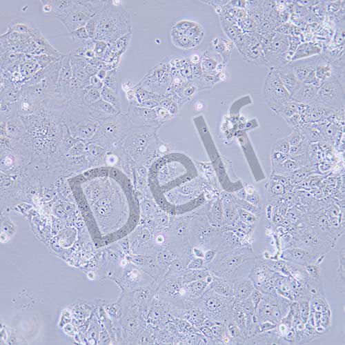 HuH-6 人肝母細胞瘤細胞