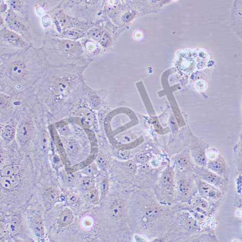 HuH-6 人肝母細胞瘤細胞