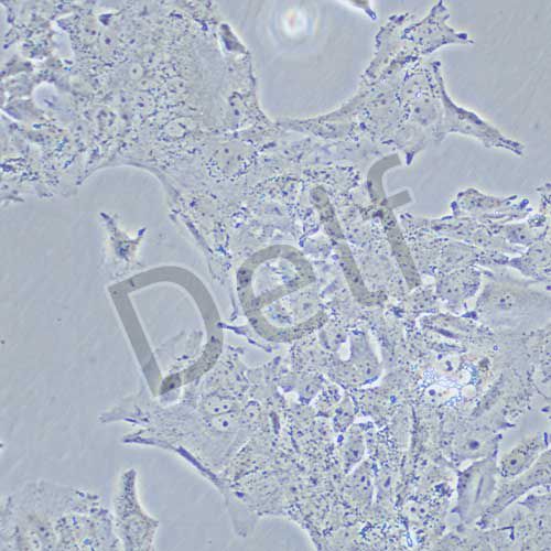 huh-7.5.1 人肝癌細(xì)胞