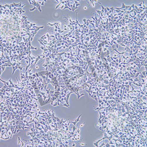 INS-1 大鼠胰島細(xì)胞瘤細(xì)胞