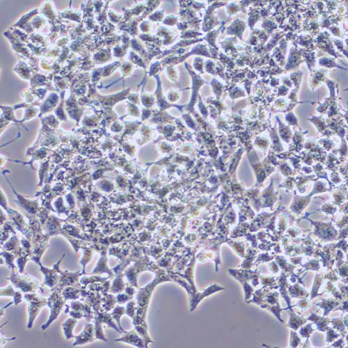 INS-1 大鼠胰島細(xì)胞瘤細(xì)胞