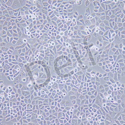 IOSE-80 人正常卵巢上皮細(xì)胞