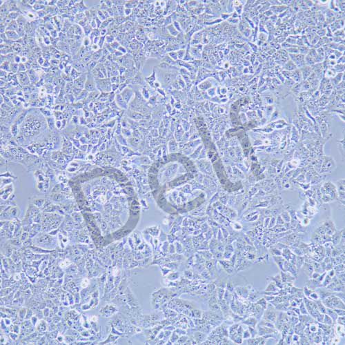 Ishikawa 人子宮內(nèi)膜癌細(xì)胞