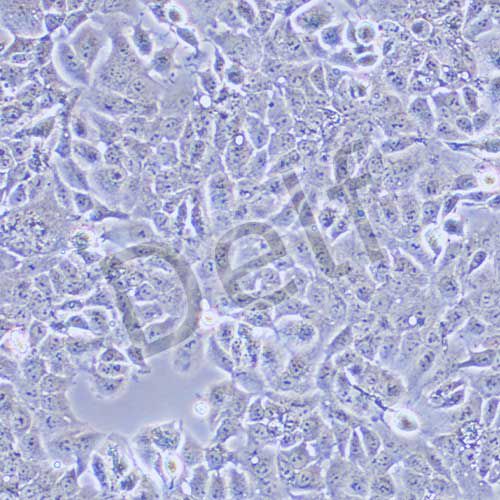 Ishikawa 人子宮內(nèi)膜癌細(xì)胞