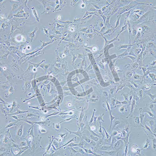 J82 人膀胱移行細胞癌