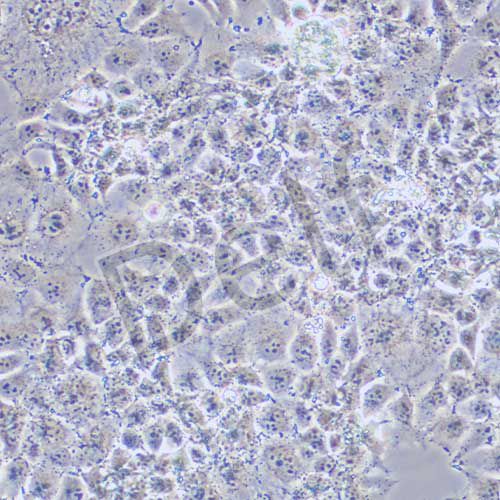 JAR 人胎盤絨毛癌細(xì)胞