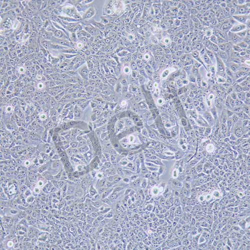 JIMT-1 人乳腺癌細胞