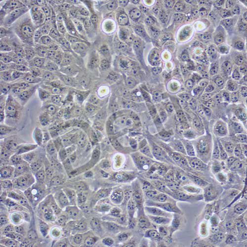 JIMT-1 人乳腺癌細胞