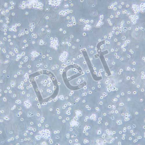 Jurkat(clone E6-1)人T淋巴細(xì)胞白血病細(xì)胞