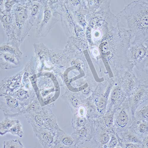 K1人甲狀腺癌細胞(暫不提供)