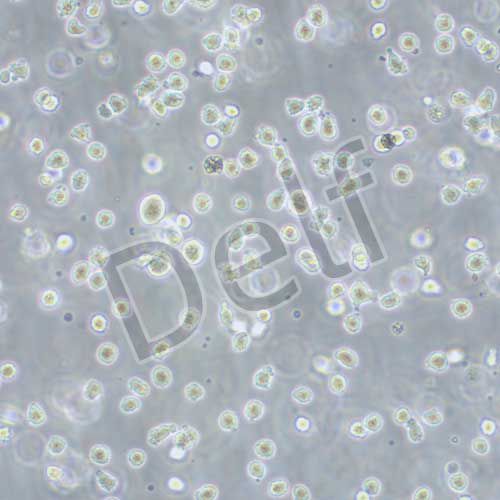 Karpas-299 人間變性大細胞淋巴瘤細胞