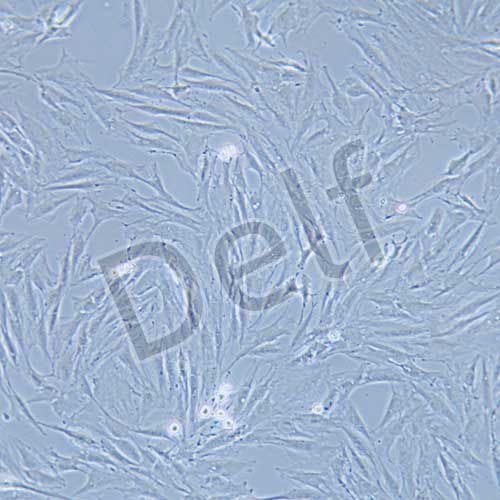 KGN 人卵巢顆粒細(xì)胞瘤細(xì)胞