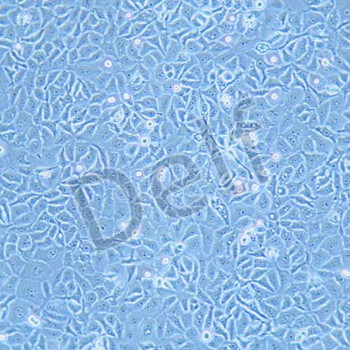 kyse30 人食道癌細胞