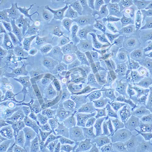 kyse30 人食道癌細胞