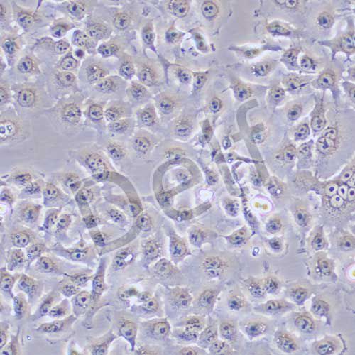 KYSE150 人食管癌細(xì)胞