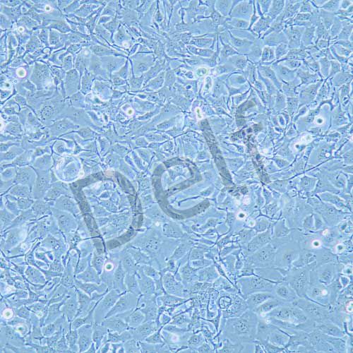 KYSE410 人食道鱗狀癌細(xì)胞