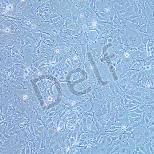 KYSE410 人食道鱗狀癌細(xì)胞