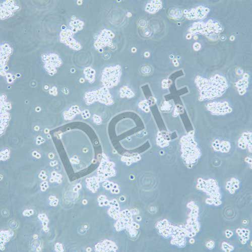 L5178Y TK 小鼠淋巴瘤細胞