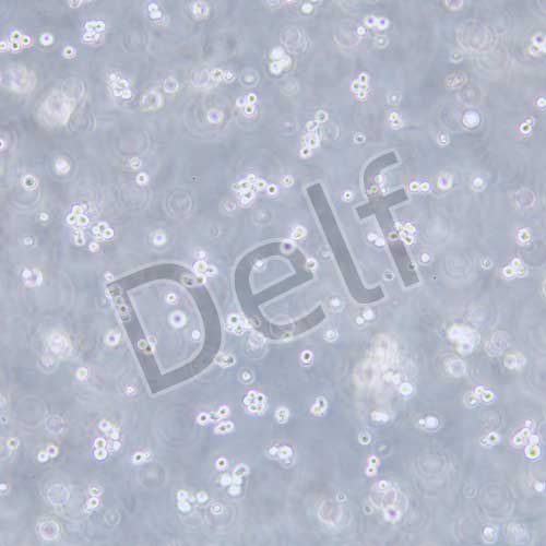 Walker/LLC-WRC 256 大鼠腹水癌細(xì)胞