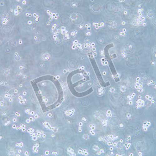 Walker/LLC-WRC 256 大鼠腹水癌細(xì)胞