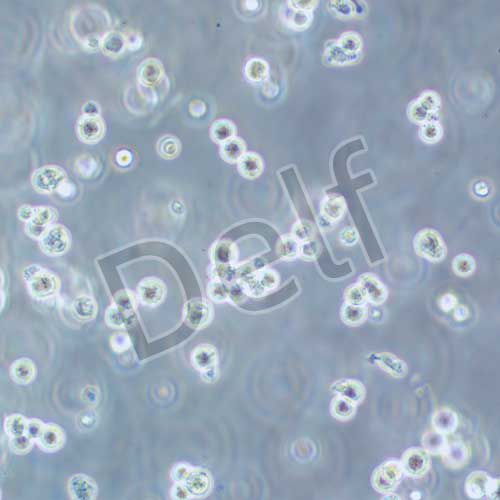 Walker/LLC-WRC 256 大鼠腹水癌細(xì)胞