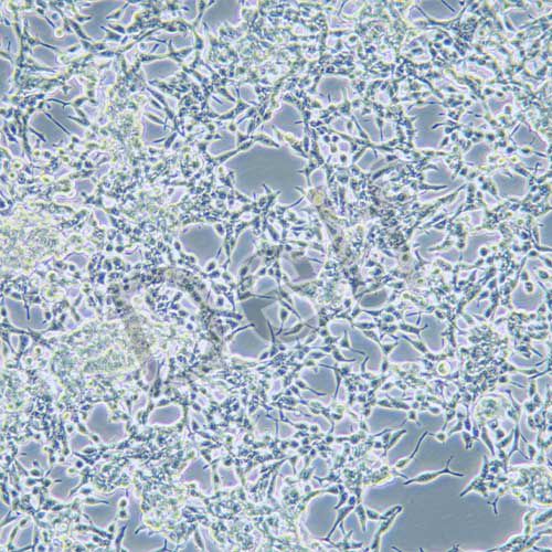 LNCaP clone FGC 人前列腺癌細胞