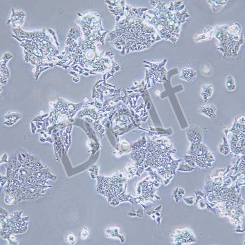 LS1034 人結(jié)腸腺癌細(xì)胞