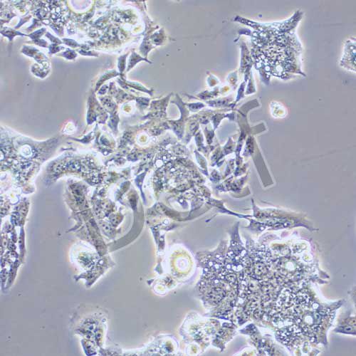 LS1034 人結(jié)腸腺癌細(xì)胞