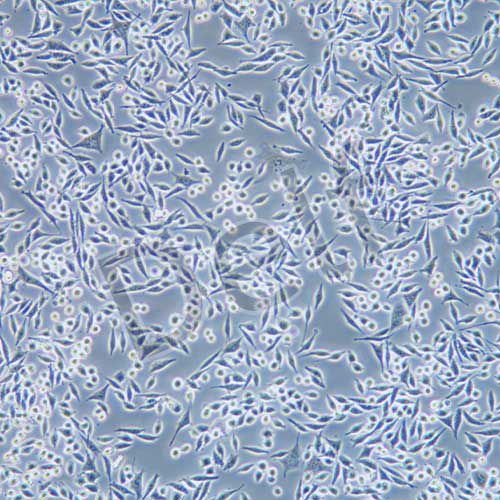 L Wnt-3A 小鼠皮下結(jié)締組織細(xì)胞