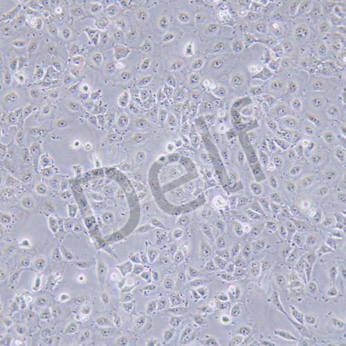 Mahlavu 人肝癌細胞