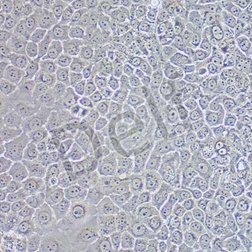 Mahlavu 人肝癌細胞