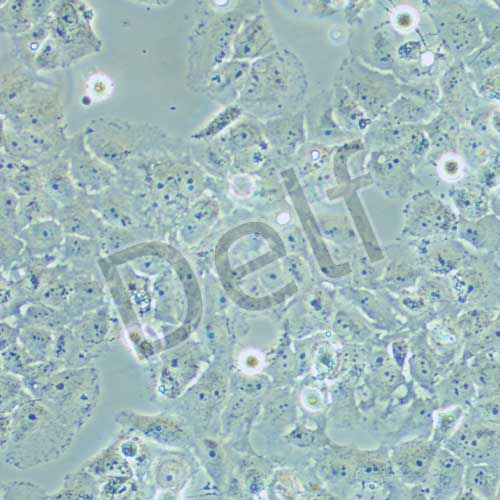 MCF-7/adr 人乳腺癌細胞阿霉素耐藥株