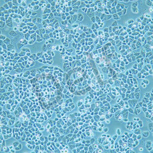MDA-MB-468 人乳腺癌細胞