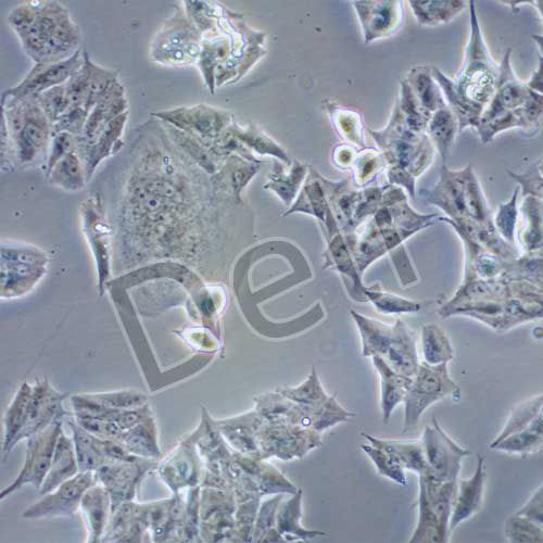 MDA-MB-361 人乳腺癌細胞